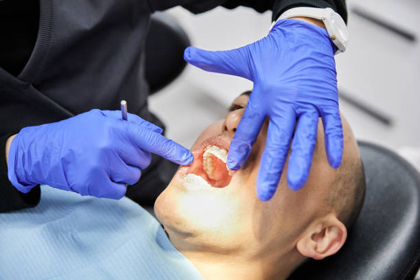 Best Emergency Dentist for Knocked-Out Tooth in Pleasant Hills, MD